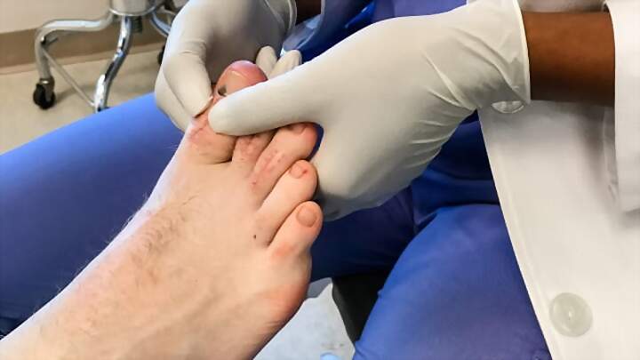 Los pies me están matando